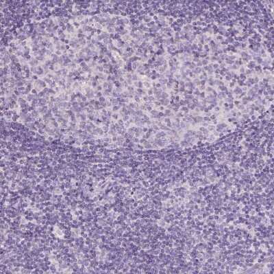 Immunohistochemistry-Paraffin AWAT2 Antibody - BSA Free
