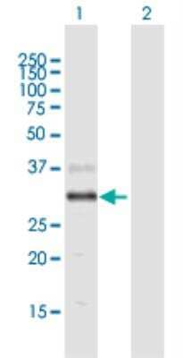 Western Blot: AWAT2 Antibody [H00158835-B01P-50ug] - Western Blot analysis of AWAT2 expression in transfected 293T cell line (H00158835-T01) by AWAT2 MaxPab polyclonal antibody.Lane 1: AWAT2 transfected lysate(36.63 kDa).Lane 2: Non-transfected lysate.