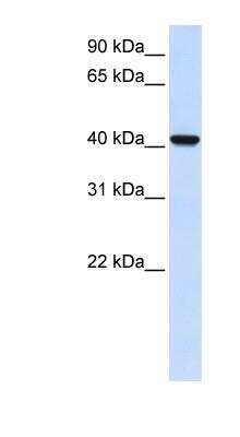 Western Blot AWAT2 Antibody - BSA Free