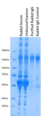 AbPure Magnetic Antibody Purification Kit [265-0200] - Rabbit serum purification. A sample of rabbit serum has been purified by using AbPure Magnetic Purification System. The gel picture shows how all the contaminants are effectively removed and the purified rabbit IgG is eluted.