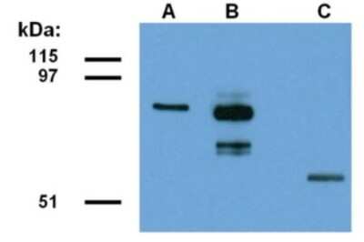 Western Blot: Abraxas Antibody (ABRA1-01) [NBP1-69762] - Detection of ABRA1-EGFP fusion protein in lysate of transfected HEK293 cells. Lane A: Immunostaining with anti-ABRA1 (clone ABRA1-01). Lane B: Immunostaining with anti-EGFP (polyclonal). Lane C: Immunostaining with anti-alpha tubulin (clone TU-01).