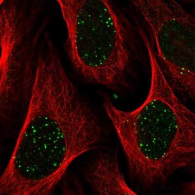 Immunocytochemistry/Immunofluorescence: Abraxas Antibody [NBP2-38356] - Staining of human cell line U-2 OS shows localization to nuclear bodies. Antibody staining is shown in green.