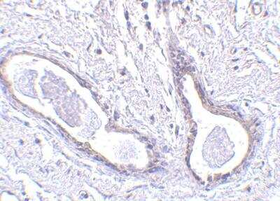 Immunohistochemistry-Paraffin: Abraxas Antibody [NBP1-76827] - Abraxas Antibody Human breast tissue with FAM175A antibody at 5 ug/ml.