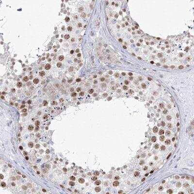 Immunohistochemistry-Paraffin: Abraxas Antibody [NBP2-38356] - Staining of human testis shows moderate nuclear positivity in cells in seminiferus ducts.