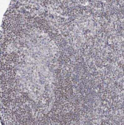 Immunohistochemistry-Paraffin: Abraxas Antibody [NBP2-38356] - Staining of human tonsil shows weak nuclear positivity in non-germinal center cell.s