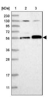 Western Blot: Abraxas Antibody [NBP2-38356] - Lane 1: Marker  [kDa] 230, 130, 95, 72, 56, 36, 28, 17, 11.  Lane 2: Human cell line RT-4.  Lane 3: Human cell line U-251MG