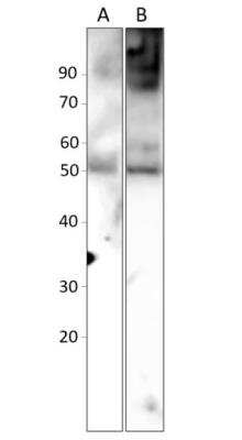 Western Blot: Abraxas Antibody [NBP3-12376] - 1) Rat colon, 2) Rat appendix. 1:250 antibody dilution in DiluObuffer. Apparent MW is 50 KDa.