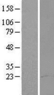 Western Blot: Abraxas Overexpression Lysate (Native) [NBP2-05609] - Abraxas Overexpression Lysate (Native) Left-Empty vector transfected control cell lysate (HEK293 cell lysate); Right -Over-expression Lysate for FAM175A.