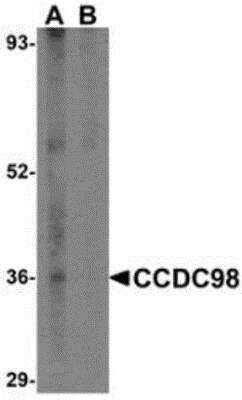 Western Blot: Abraxas Peptide [NBP1-76827PEP] - Abraxas Peptide blocks the antibody activity completely in Western blot by incubating the peptide with equal volume of antibody for 30 min at 37C.