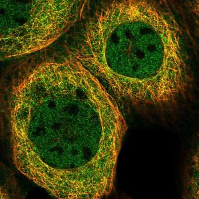 Immunocytochemistry/Immunofluorescence: Absent in melanoma 1 Antibody [NBP2-38170] - Immunofluorescent staining of human cell line A-431 shows localization to nucleoplasm & microtubules.