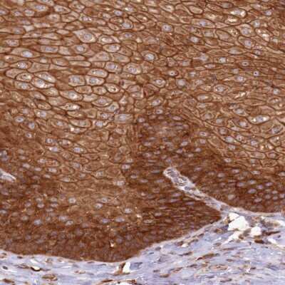 Immunohistochemistry: Absent in melanoma 1 Antibody [NBP2-38170] - Staining of human esophagus shows strong cytoplasmic positivity in squamous epithelial cells.