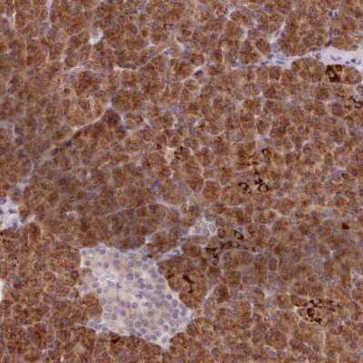 Immunohistochemistry: Absent in melanoma 1 Antibody [NBP2-38171] - Staining of human pancreas shows strong cytoplasmic positivity in exocrine glandular cells.