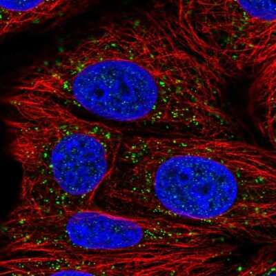 Immunocytochemistry/Immunofluorescence: Acetoacetyl CoA synthetase Antibody [NBP2-38861] - Immunofluorescent staining of human cell line MCF7 shows localization to vesicles.