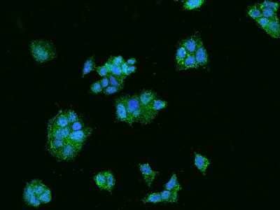 Immunocytochemistry/ Immunofluorescence Acetoacetyl CoA synthetase Antibody - BSA Free