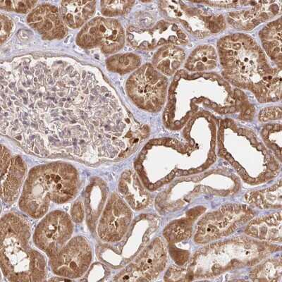 Immunohistochemistry: Acetoacetyl CoA synthetase Antibody [NBP2-38861] - Staining of human kidney shows strong cytoplasmic positivity in cells in tubules.