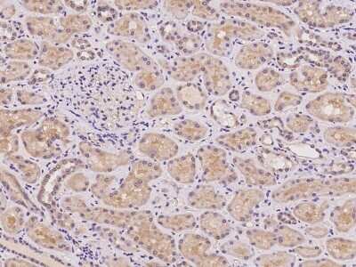Immunohistochemistry-Paraffin: Acetoacetyl CoA synthetase Antibody [NBP2-97174] - Human kidney with rabbit polyclonal antibody at 1:100 dilution.