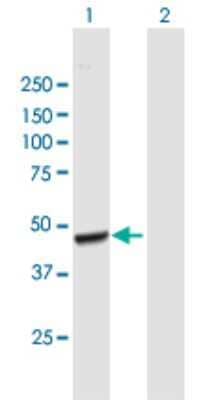 Western Blot: Acetoacetyl CoA synthetase Antibody [H00065985-B01P] - Analysis of AACS expression in transfected 293T cell line by AACS polyclonal antibody.  Lane 1: AACS transfected lysate(45.1 KDa). Lane 2: Non-transfected lysate.