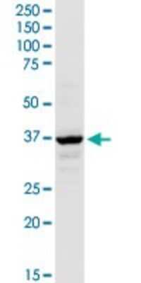 Western Blot: Acetoacetyl CoA synthetase Antibody [H00065985-D01P] - Analysis of AACS expression in mouse liver.