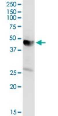 Western Blot: Acetoacetyl CoA synthetase Antibody [H00065985-D01P] - Analysis of AACS expression in rat brain.