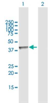Western Blot: Acetoacetyl CoA synthetase Antibody [H00065985-D01P] - Analysis of AACS expression in transfected 293T cell line by AACS polyclonal antibody.Lane 1: AACS transfected lysate(45.60 KDa).Lane 2: Non-transfected lysate.
