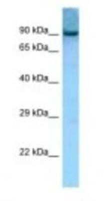 Western Blot Acetoacetyl CoA synthetase Antibody - BSA Free