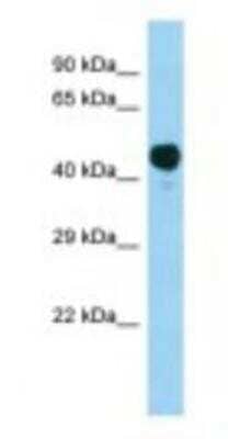 Western Blot: Acetoacetyl CoA synthetase Antibody [NBP1-98507] - Rat Muscle Lysate 1.0ug/ml, Gel Concentration: 12%