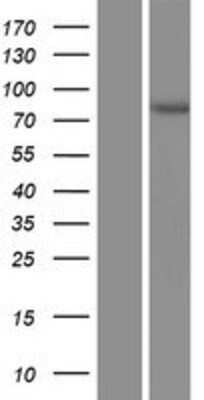 Western Blot: Acetoacetyl CoA synthetase Overexpression Lysate (Adult Normal) [NBP2-06369] Left-Empty vector transfected control cell lysate (HEK293 cell lysate); Right -Over-expression Lysate for Acetoacetyl CoA synthetase.