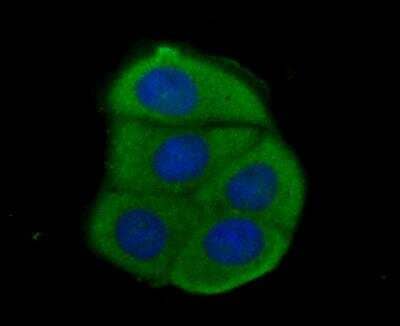 Immunocytochemistry/Immunofluorescence: Acetyl-CoA Carboxylase alpha/ACACA Antibody [NBP2-89114] - Staining Acetyl CoA Carboxylase 1 (ACC1) in MCF-7 cells (green). Formalin fixed cells were permeabilized with 0.1% Triton X-100 in TBS for 10 minutes at room temperature and blocked with 1% Blocker BSA for 15 minutes at room temperature. Cells were probed with the antibody at a dilution of 1:100 for 1 hour at room temperature, washed with PBS. Alexa Fluor(TM) 488 Goat anti-Rabbit IgG was used as the secondary antibody at 1/100 dilution. The nuclear counter stain is DAPI (blue).
