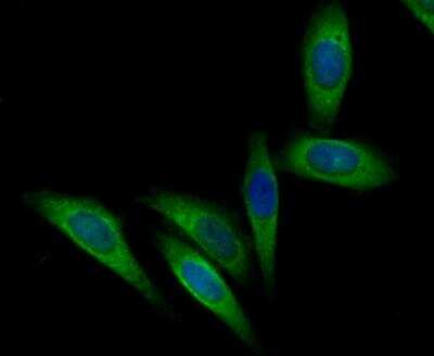 Immunocytochemistry/Immunofluorescence: Acetyl-CoA Carboxylase alpha/ACACA Antibody [NBP2-89114] - Staining Acetyl CoA Carboxylase 1 (ACC1) in SiHa cells (green). Formalin fixed cells were permeabilized with 0.1% Triton X-100 in TBS for 10 minutes at room temperature and blocked with 1% Blocker BSA for 15 minutes at room temperature. Cells were probed with the antibody at a dilution of 1:200 for 1 hour at room temperature, washed with PBS. Alexa Fluor(TM) 488 Goat anti-Rabbit IgG was used as the secondary antibody at 1/100 dilution. The nuclear counter stain is DAPI (blue).