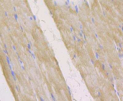 Immunohistochemistry-Paraffin: Acetyl-CoA Carboxylase alpha/ACACA Antibody [NBP2-89114] - Analysis of paraffin-embedded rat skeletal muscle tissue using anti-Acetyl CoA Carboxylase 1 (ACC1) antibody. The section was pre-treated using heat mediated antigen retrieval with Tris-EDTA buffer (pH 8.0-8.4) for 20 minutes.The tissues were blocked in 5% BSA for 30 minutes at room temperature, washed with ddH2O and PBS, and then probed with the antibody at 1/200 dilution, for 30 minutes at room temperature and detected using an HRP conjugated compact polymer system. DAB was used as the chrogen. Counter stained with hematoxylin and mounted with DPX.
