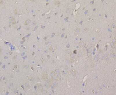 Immunohistochemistry-Paraffin: Acetyl-CoA Carboxylase alpha/ACACA Antibody [NBP2-89114] - Immunohistochemical analysis of paraffin-embedded mouse brain tissue using anti-Acetyl-CoA Carboxylase alpha/ACACA antibody. The section was pre-treated using heat mediated antigen retrieval with Tris-EDTA buffer (pH 8.0-8.4) for 20 minutes. The tissues w