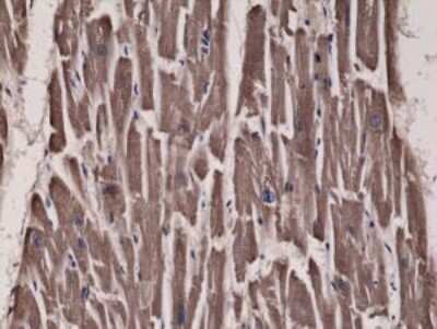 Immunohistochemistry-Paraffin: Acetyl-CoA Carboxylase alpha/ACACA Antibody (RM232) [NBP2-61471] - Immunohistochemical staining of formalin fixed and paraffin embedded Human heart tissue sections using NBP2-61471 at a 1:300 dilution.