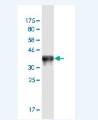 Western Blot: Acetyl Coenzyme A Carboxylase Beta Antibody (3E8) [H00000032-M02A-200ul] - Detection against Immunogen (36.63 KDa) .