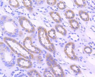 Immunohistochemistry-Paraffin: Acetyl Coenzyme A Carboxylase Beta Antibody (ST53-08) [NBP2-67545] - Analysis of paraffin-embedded human kidney tissue using anti-Acetyl CoA Carboxylase 1 antibody. Counter stained with hematoxylin.