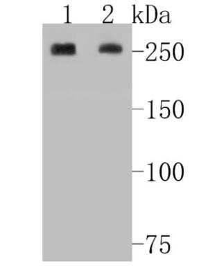 Western Blot: Acetyl Coenzyme A Carboxylase Beta Antibody (ST53-08) [NBP2-67545] - Analysis of Acetyl CoA Carboxylase 1(ACC1) on different lysates. Proteins were transferred to a PVDF membrane and blocked with 5% BSA in PBS for 1 hour at room temperature. The primary antibody ( 1/500) was used in 5% BSA at room temperature for 2 hours. Goat Anti-Rabbit IgG - HRP Secondary Antibody  at 1:5,000 dilution was used for 1 hour at room temperature. Positive control: Lane 1: A549 cell lysate Lane 2: mouse liver tissue lysate