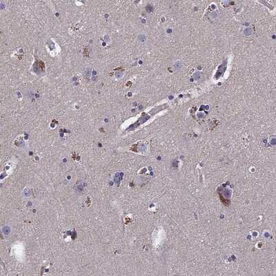Immunohistochemistry-Paraffin: Acetyl-coenzyme A transporter 1 Antibody [NBP1-90811] - Staining of human cerebral cortex shows strong cytoplasmic positivity in neuronal cells.