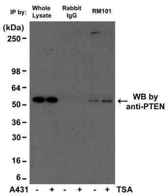 Immunoprecipitation: Acetyl-Lysine Antibody (RM101) [NBP2-77397] - A431 cell lysates, using NBP2-77397, was blotted with anti-PTEN mouse monoclonal antibody.