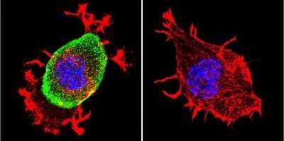 Immunocytochemistry/Immunofluorescence: Acetylcholinesterase/ACHE Antibody (HR2) [NB300-528] - Analysis of Acetylcholinesterase using Anti-Acetylcholinesterase Monoclonal Antibody (HR2) shows staining in Neuro-2a Cells. Acetylcholinesterase staining (green), F-Actin staining with Phalloidin (red) and nuclei with DAPI (blue) is shown. Cells were grown on chamber slides and fixed with formaldehyde prior to staining. Cells were probed without (control) or with or an antibody recognizing Acetylcholinesterase at a dilution of 1:200 over night at 4C, washed with PBS and incubated with a DyLight-488 conjugated.