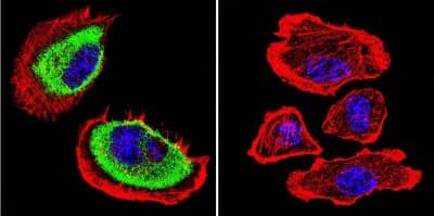 Immunocytochemistry/Immunofluorescence: Acetylcholinesterase/ACHE Antibody (HR2) [NB300-528] - Analysis of Acetylcholinesterase using Anti-Acetylcholinesterase Monoclonal Antibody (HR2) shows staining in U251 Cells. Acetylcholinesterase staining (green), F-Actin staining with Phalloidin (red) and nuclei with DAPI (blue) is shown. Cells were grown on chamber slides and fixed with formaldehyde prior to staining. Cells were probed without (control) or with or an antibody recognizing Acetylcholinesterase at a dilution of 1:200 over night at 4C, washed with PBS and incubated with a DyLight-488 conjugated.