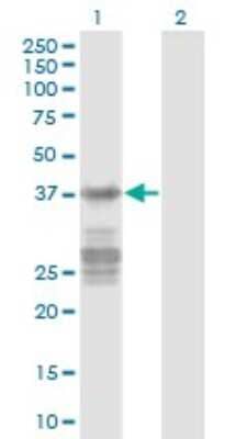 Western Blot: Acidic Calponin Antibody (2C7) [H00001266-M03] - Analysis of CNN3 expression in transfected 293T cell line by CNN3 monoclonal antibody (M03), clone 2C7. Lane 1: CNN3 transfected lysate (Predicted MW: 36.4 KDa). Lane 2: Non-transfected lysate.
