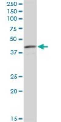 Western Blot: Acidic Calponin Antibody (4C4) [H00001266-M01] - CNN3 monoclonal antibody (M01), clone 4C4. Analysis of CNN3 expression in HepG2.