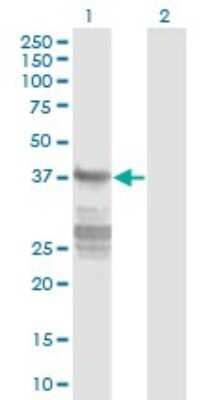 Western Blot: Acidic Calponin Antibody (4C4) [H00001266-M01] - Analysis of CNN3 expression in transfected 293T cell line by CNN3 monoclonal antibody (M01), clone 4C4.Lane 1: CNN3 transfected lysate (Predicted MW: 36.4 KDa).Lane 2: Non-transfected lysate.