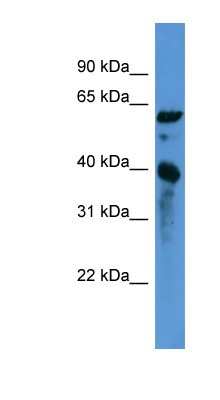 Western Blot: Acidic Calponin Antibody [NBP1-68944] - Titration: 0.2-1 ug/ml, Positive Control: 293T cell lysate.