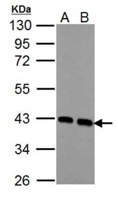 Western Blot: Acidic Calponin Antibody [NBP2-15242] - Sample (30 ug of whole cell lysate) A: NIH-3T3 B: JC 10% SDS PAGE; antibody diluted at 1:1000.