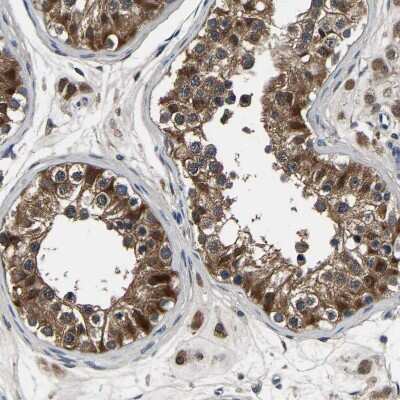 Recombinant Human/Mouse/Rat Activin A Protein (338-AC): Novus 