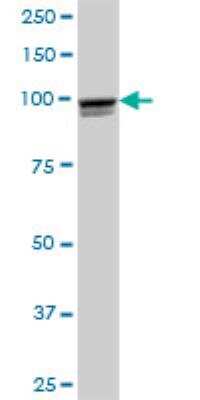 Western Blot: Aconitase 1 Antibody [H00000048-B01P] - Analysis of ACO1 expression in human liver.