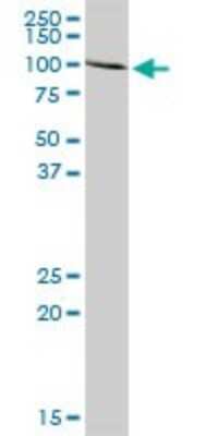 Western Blot: Aconitase 1 Antibody [H00000048-D01P] - Analysis of ACO1 expression in human liver.
