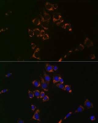 Immunocytochemistry/Immunofluorescence: Aconitase 2 Antibody (0P3H3) [NBP3-16426] - Immunofluorescence analysis of NIH-3T3 cells using Aconitase 2 (ACO2) Rabbit mAb (NBP3-16426) at dilution of 1:100 (40x lens). Blue: DAPI for nuclear staining.