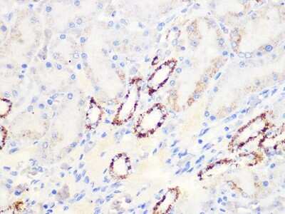 Immunohistochemistry-Paraffin: Aconitase 2 Antibody (0P3H3) [NBP3-16426] - Immunohistochemistry of paraffin-embedded rat kidney using Aconitase 2 (ACO2) Rabbit mAb (NBP3-16426) at dilution of 1:100 (40x lens).Perform microwave antigen retrieval with 10 mM PBS buffer pH 7.2 before commencing with IHC staining protocol.