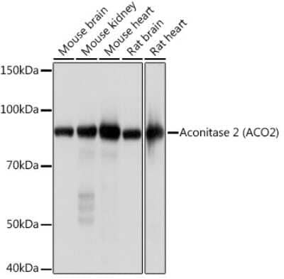 Western Blot: Aconitase 2 Antibody (0P3H3) [NBP3-16426] - Western blot analysis of extracts of various cell lines, using Aconitase 2 (ACO2) Rabbit mAb (NBP3-16426) at 1:1000 dilution. Secondary antibody: HRP Goat Anti-Rabbit IgG (H+L) at 1:10000 dilution. Lysates/proteins: 25ug per lane. Blocking buffer: 3% nonfat dry milk in TBST. Detection: ECL Basic Kit. Exposure time: 1s.